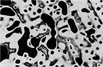 Microstructure of continuous cast leaded tin bronze alloy C94100 (20%Pb).