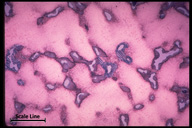 Microstructure