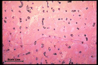 Microstructure