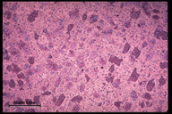 Microstructure